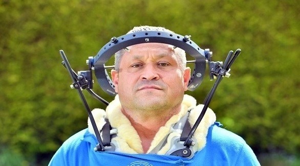 يعيش مع حلقة معدنية مثبتة بجمجمته