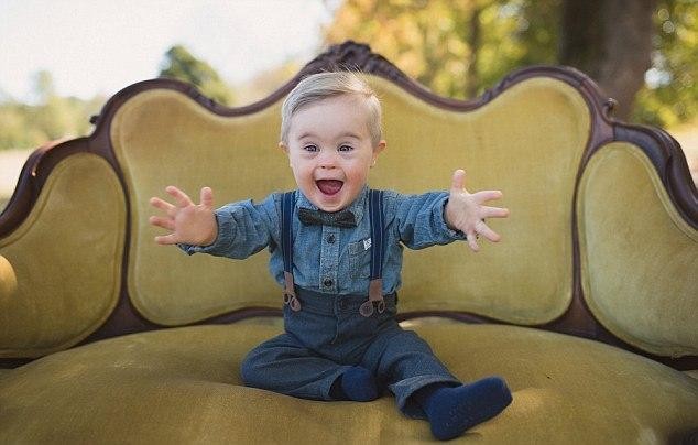 بالصور: كيف أصبح طفل مصاب بمتلازمة