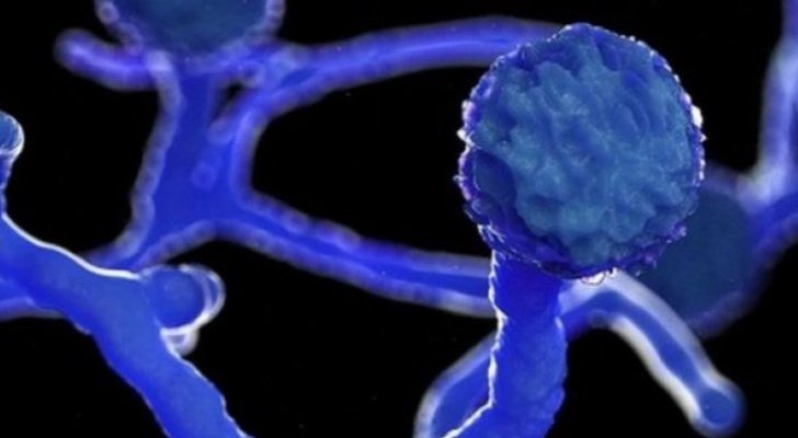 طبيب يتحدث عن طريقة تجنب الإصابة