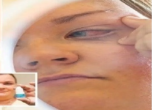 تغلق عينها بعدما وضعت صمغ الأظافر