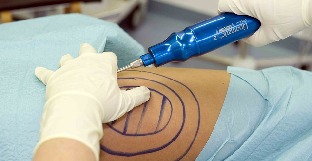 وزير الصحة اللبناني: التحقيق مستمر بوفاة