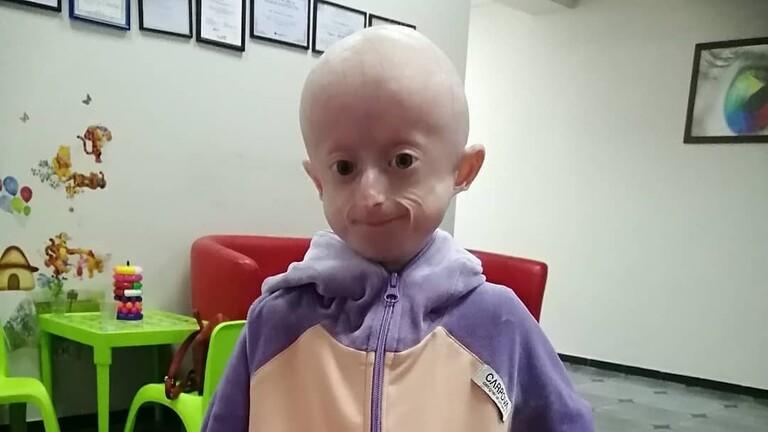 وفاة طفلة عمرها 10 أعوام جراء