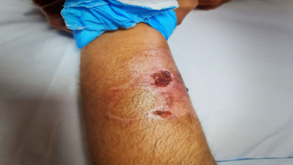 مخاطبة الطب الشرعي لإعادة فحص طفل