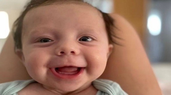 طفلة تتحول إلى حجر بسبب حالة