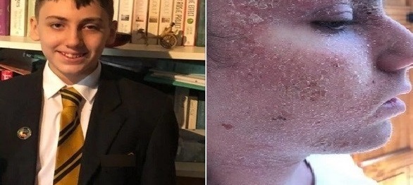 يطلب وضعه في غيبوبة ليتخلص من