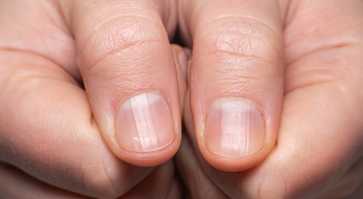 علامة على الأصابع أو الأظافر تشير