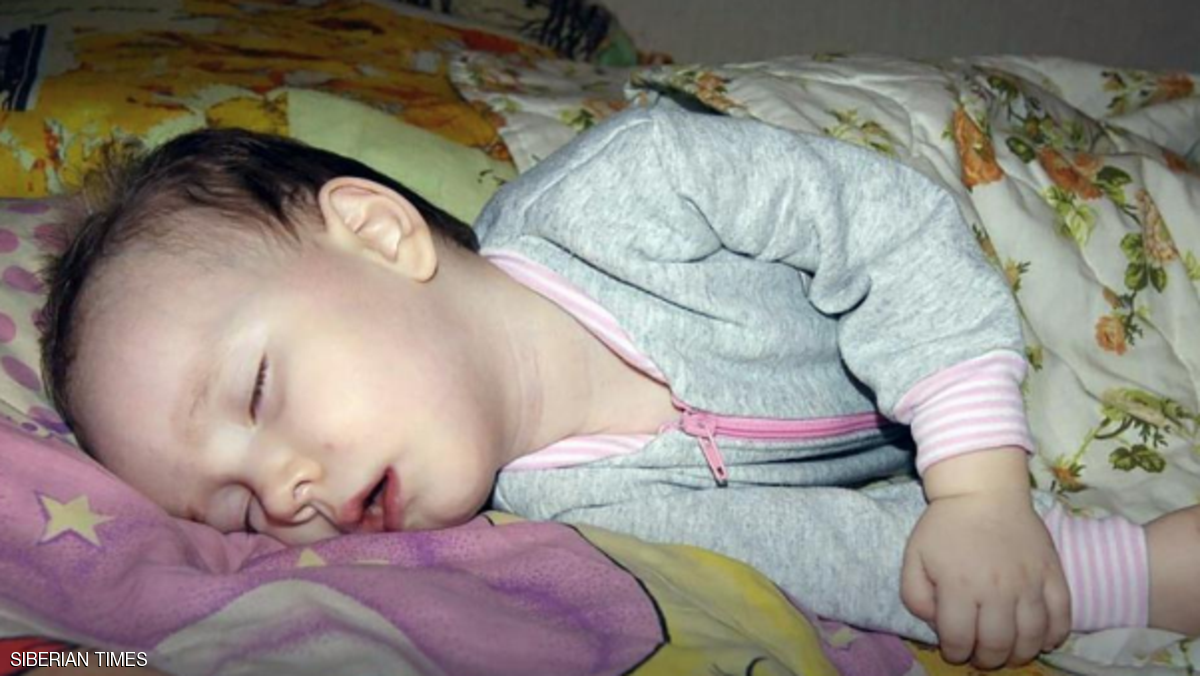 طفلة روسية تحيّر الأطباء
