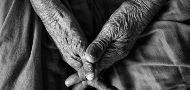 هل تؤثر التغذية على ظهور علامات