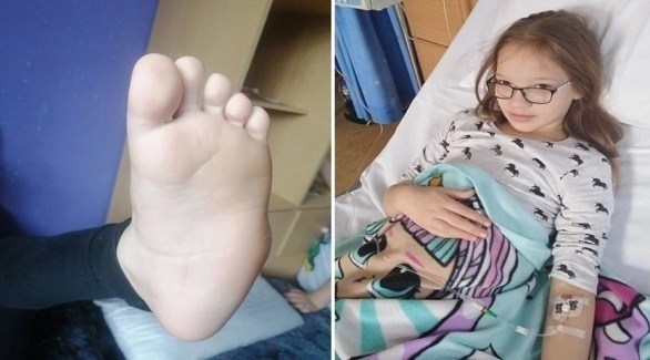 طفلة ترغب ببتر قدمها لتتخلص من