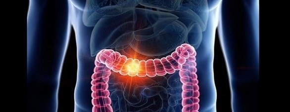 تركيبة أدوية متطورة تعطي الأمل لمرضى
