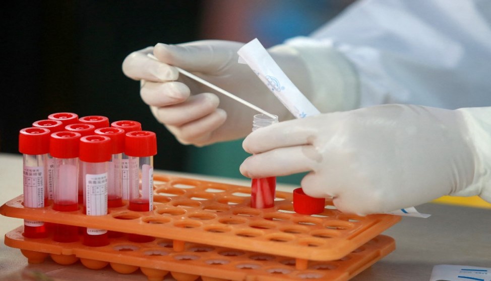 الحجاوي: 4.08% نسبة الفحوصات الايجابية للاسبوع