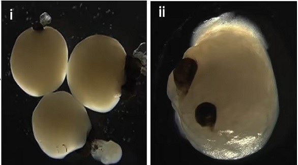 زراعة هياكل للعين يمكنها استشعار الضوء
