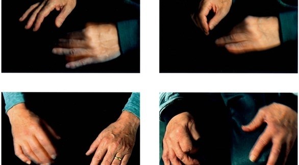 علاج جديد لمرض باركنسون