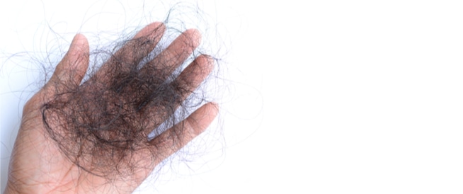 6 من أفضل الزيوت الطبيعية لمنع