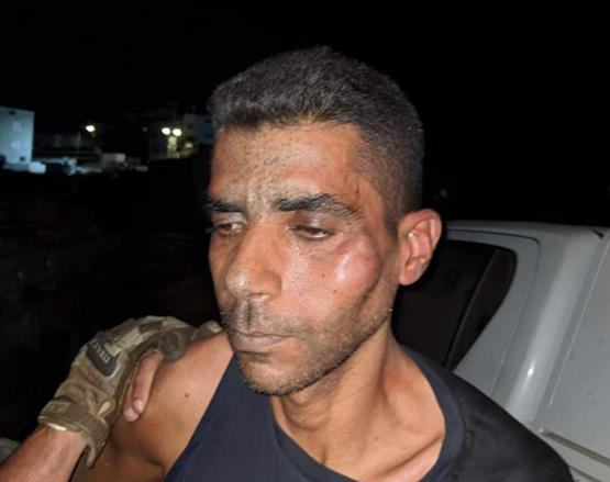 الاحتلال انهال بالضرب على الزبيدي