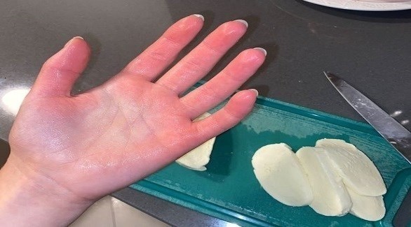 تعاني من حساسية شديدة تجاه البرد