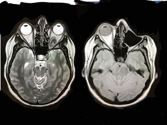 تطفىء الشموع بعينها بعدما أزالتها بسبب