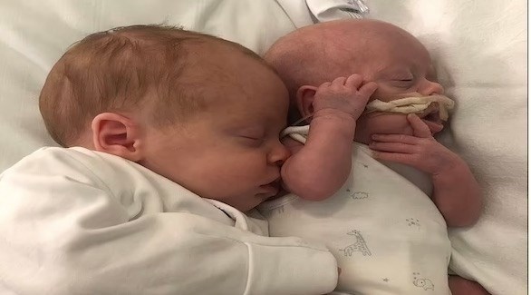 نجاة رضيع يزن 500 غرام بفضل