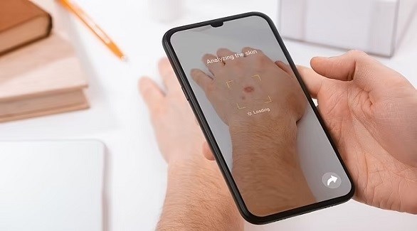 تطبيقات تشخيص سرطان الجلد تهدد حياة