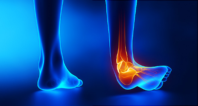 آلام الساق تنذر بهذا المرض الخطير