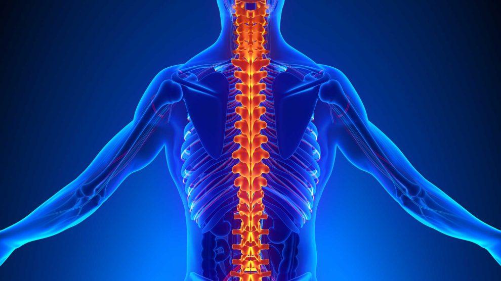 يسمى القعس.. ماذا نعرف عن انحناء