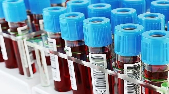 ما هو كسل العين لدى الأطفال؟