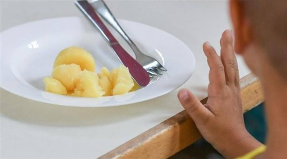 رفض الطفل للطعام ينذر بهذا الاضطراب