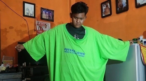 أثقل طفل في العالم يخسر 120