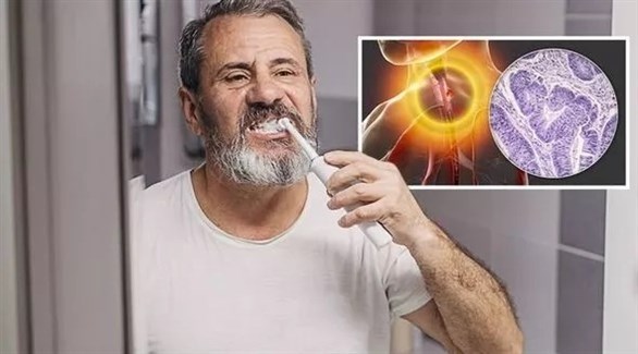 إهمال تنظيف الأسنان يزيد احتمال الإصابة