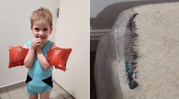 طفل يعاني من حالة نادرة تجعله