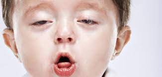 السعال الديكي يهاجم الصغار والكبار أيضا