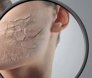 ليست الكريمات.. ما هي أفضل الطرق