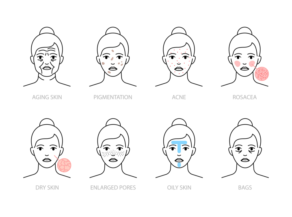 البشرة الحساسة ليست ضمنها.. ما هي