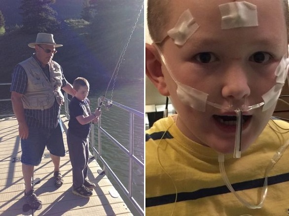 طفل يتحول إلى حجر بسبب حالة