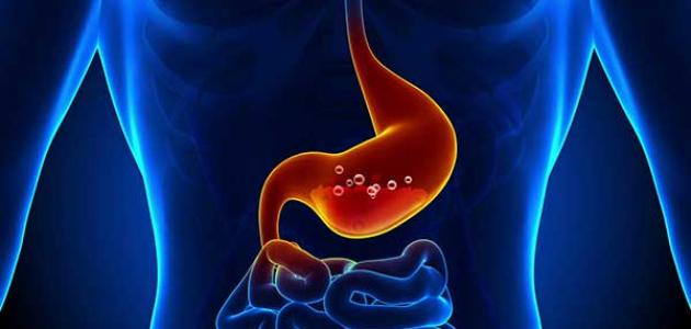 نصائح لمواجهة حموضة المعدة بالتغذية الصحية