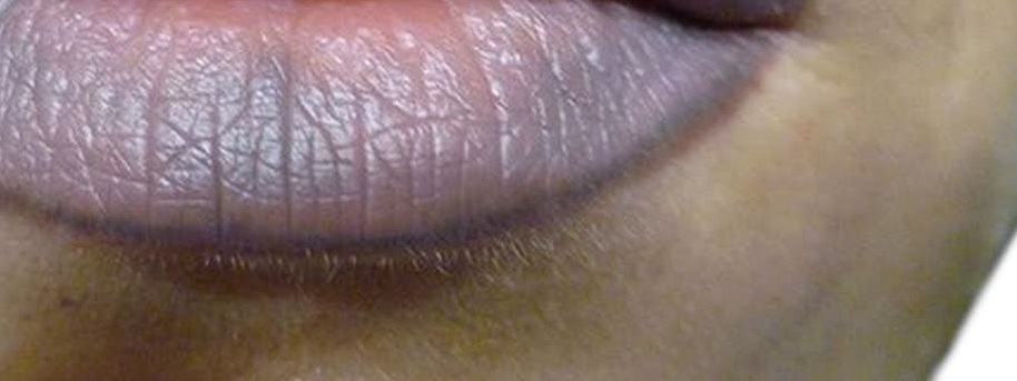 هل تغير لون شفاهك للأسود أو