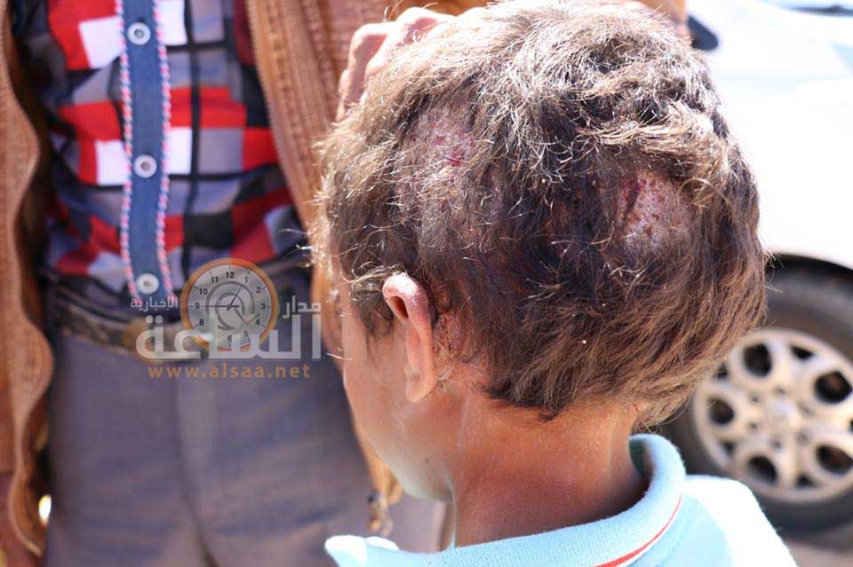 حدث في الثغرة بمعان.. (صور صادمة)