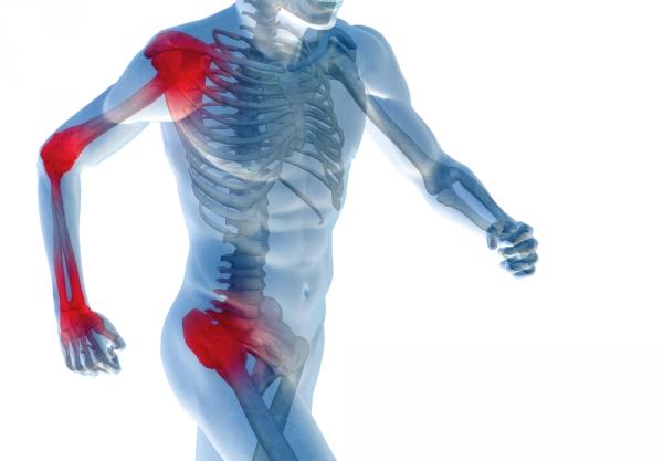 (20 50) % من الالتهابات مقاومة