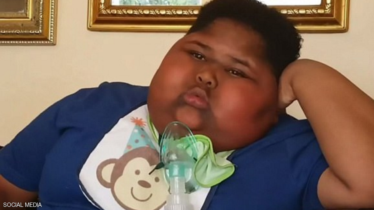 طفل يعاني شهية «استثنائية» ويأكل كل