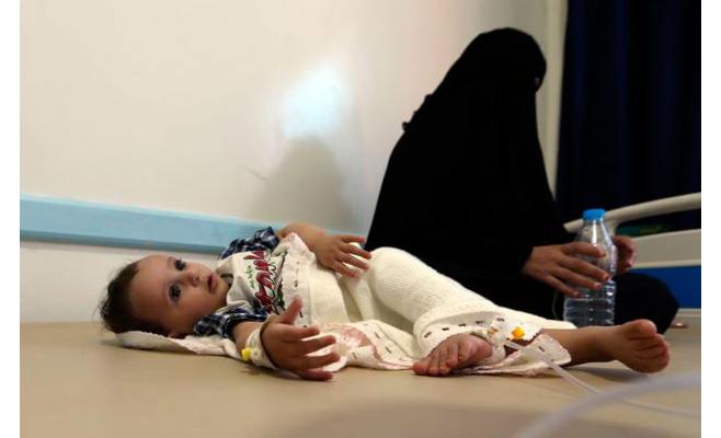 حالات الإصابة بالكوليرا في اليمن تجاوزت