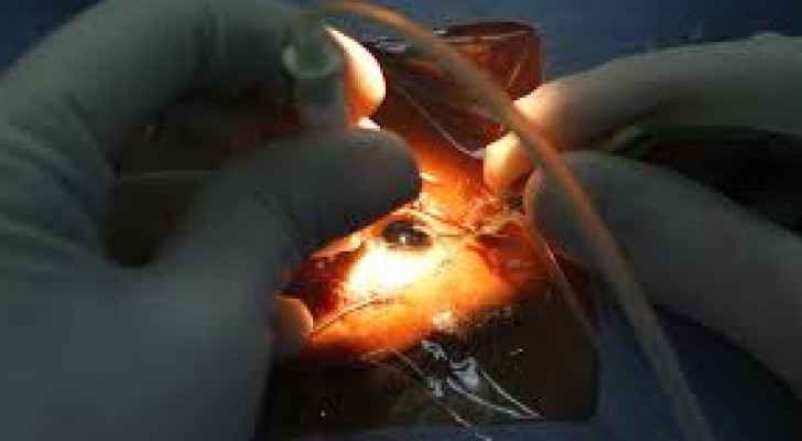 شاب صينى يستعيد الرؤية بعينه اليمنى