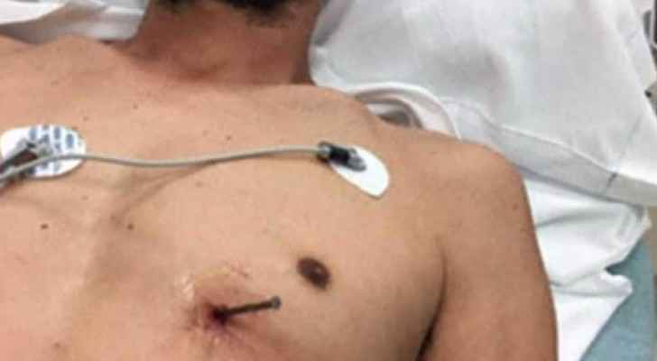 أمريكي ينجو بحياته بعد استقرار مسمار