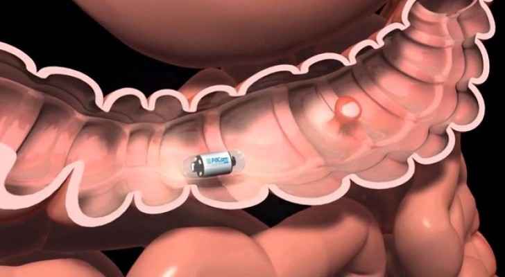 كاميرا طبية تصور داخل جسم الإنسان