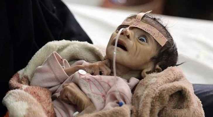 الأمم المتحدة تلوم السعودية: 1639. 1635