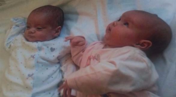 طفلتان توأم تولدان بفارق 87 يوما