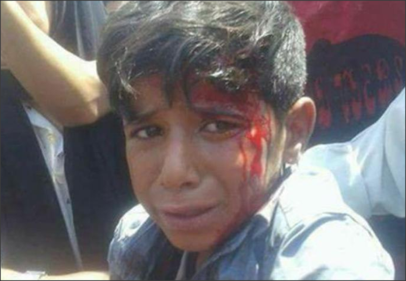 والد طفل «الحلابات»: لا علاقة لموكب