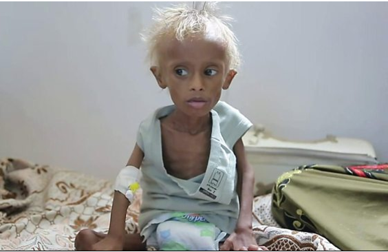 الطفل الذي صدم العالم