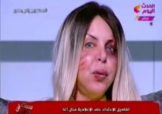 فيديو.. لماذا ظهرت هذه المذيعة مضروبة