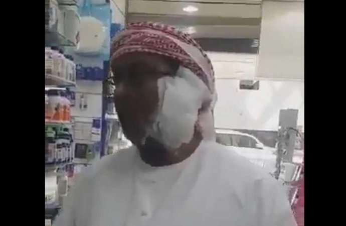 آيفون 8 ينفجر في وجه مواطن