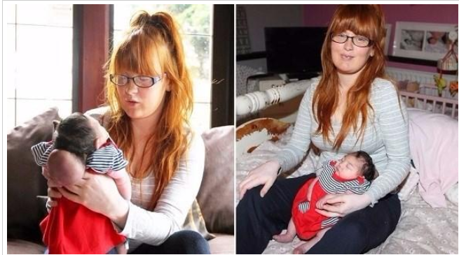 طفلة تولد ودماغها خارج جمجمتها